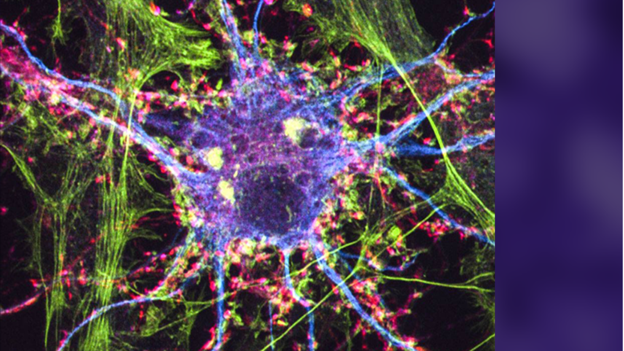 Graphic with a blown up model of a neuron portrayed in many colors